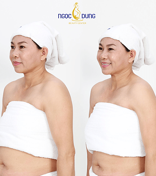 Giảm mỡ là điều mọi lứa tuổi cần chú ý.
