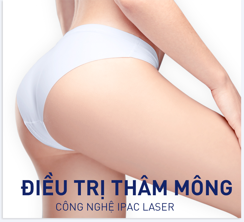 Thông tin về laser trị thâm mông thẩm mỹ và hiệu quả