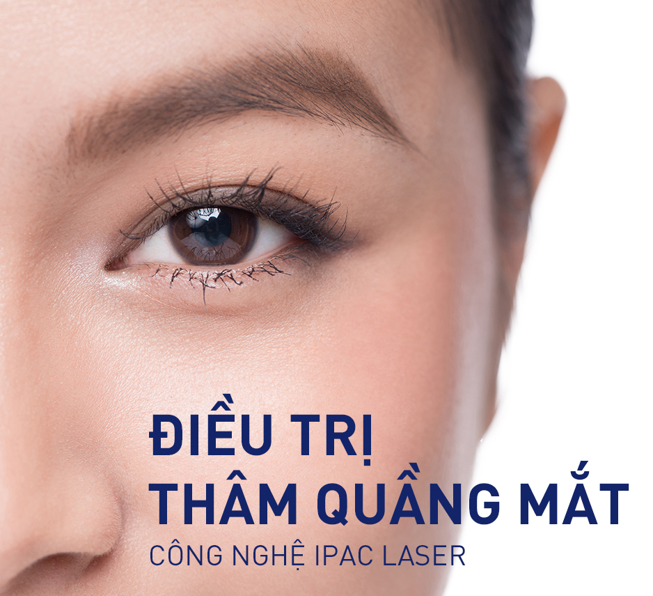 Ánh sáng của laser được sử dụng như thế nào trong quá trình trị thâm quầng mắt?
