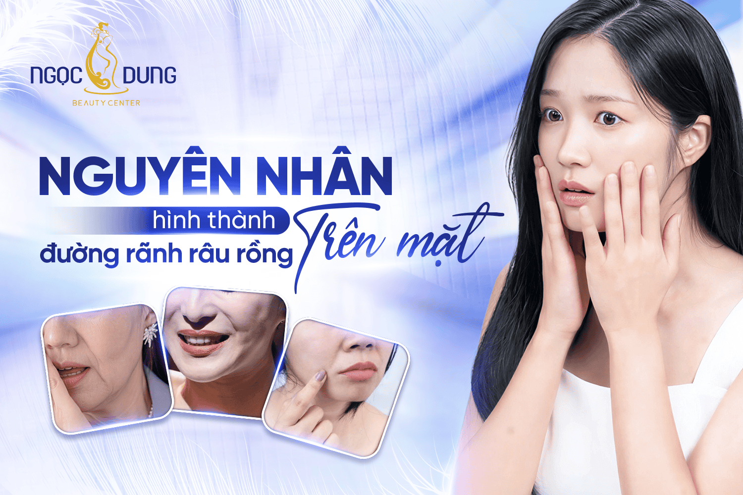 Nguyên nhân hình thành đường rãnh rồng trên mặt 