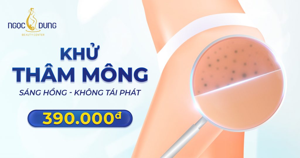 Tại sao mông bị thâm?
