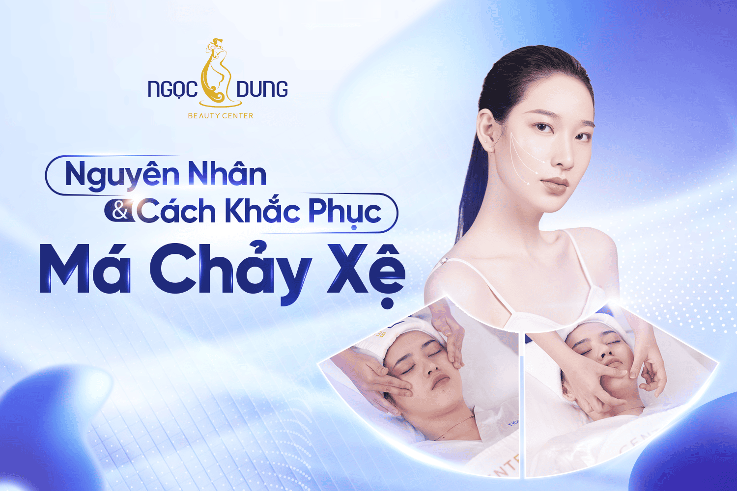 Nguyên nhân và cách khắc phục má chảy xệ