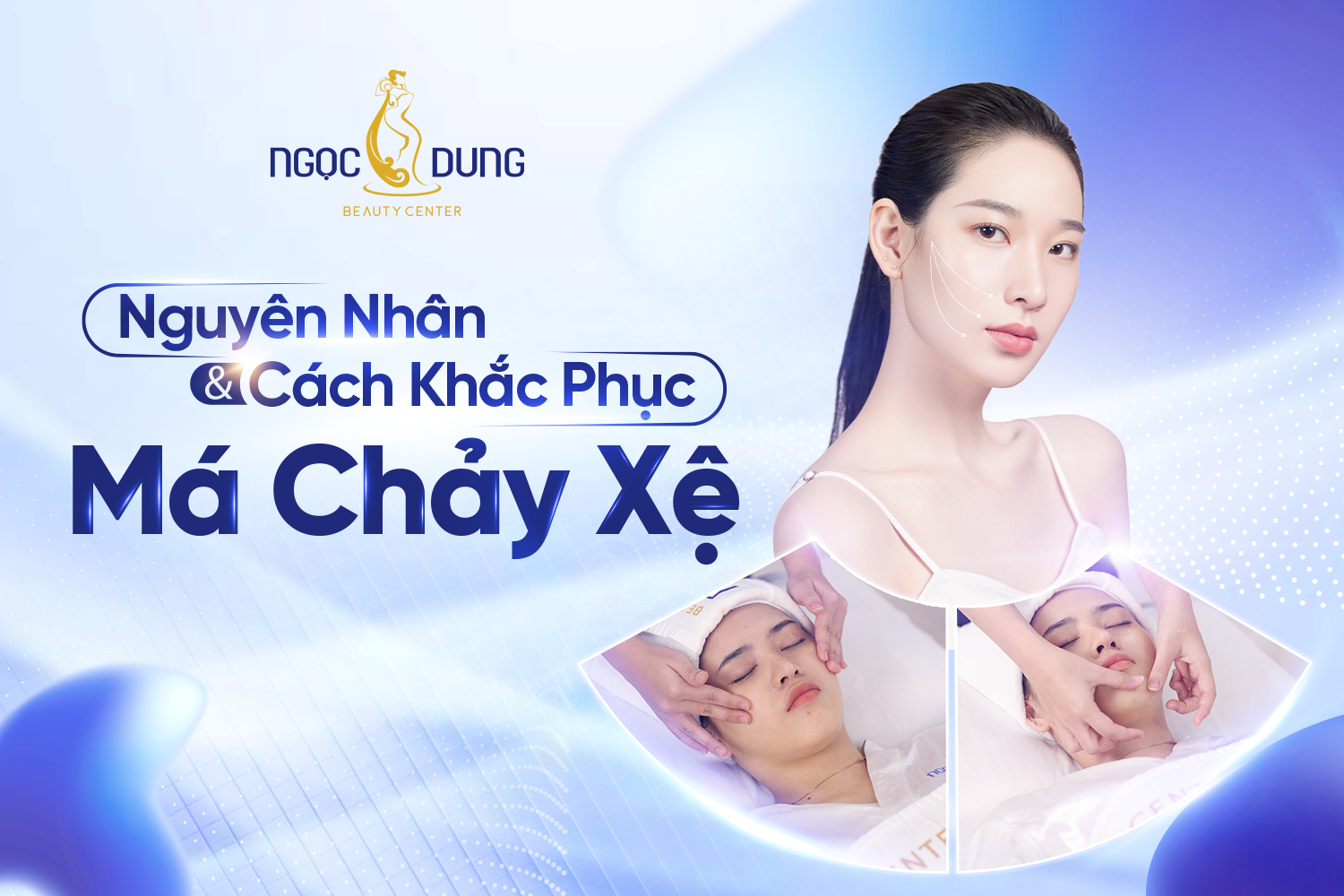 20260306 Pos SEO 931