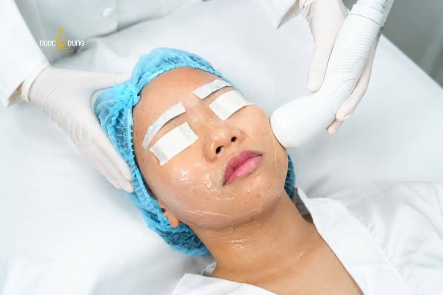 Hifu là một trong những phương pháp cải thiện tình trạng má chảy xệ có hiệu quả cao