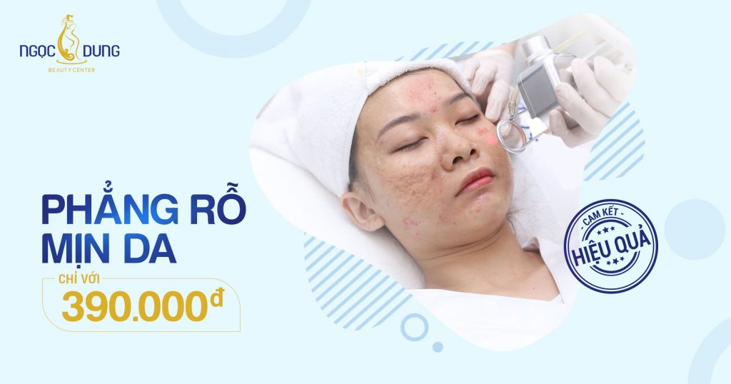 tri-seo-ro-tmv-ngoc-dung
