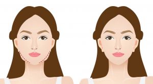 cach giam beo mat va cam