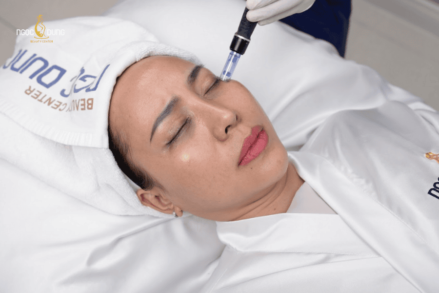 Quy trình điều trị thâm mắt bằng công nghệ cao tại TMV Ngọc Dung