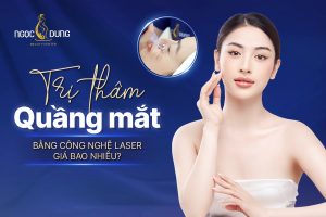 Trị thâm quầng mắt bằng công nghệ laser giá bao nhiêu