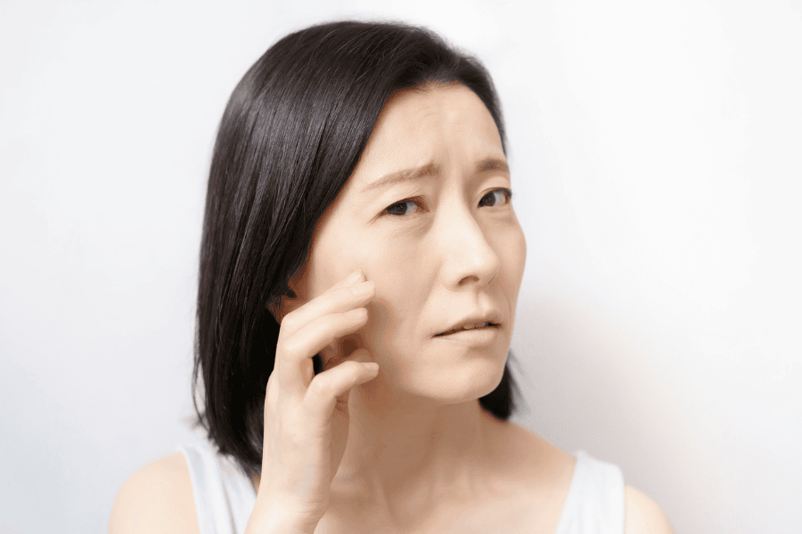 Lão hóa da sớm là gì? Dấu hiệu, nguyên nhân và khắc phục 3 Nếp nhăn và da chảy xệ là dấu hiệu điển hình và dễ nhận thấy nhất của lão hóa da