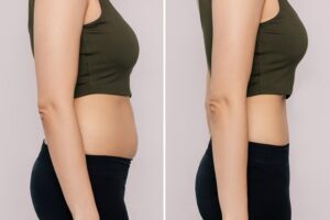 cách giảm mỡ bụng
