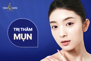Trị thâm mụn như thế nào hiệu quả?