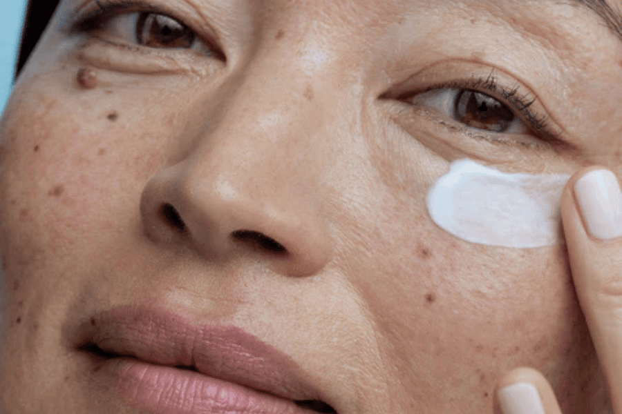 AHA phù hợp với người có làn da khô, da xỉn màu hoặc nám nhẹ