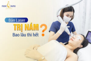 Bắn laser trị nám bao lâu thì hết
