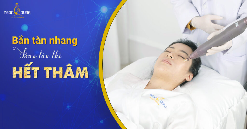 Bắn tàn nhang bao lâu thì hết thâm