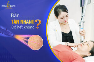 Bắn tàn nhang có hết không