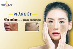 nám mảng và nám chân sâu