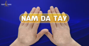Nám da tay