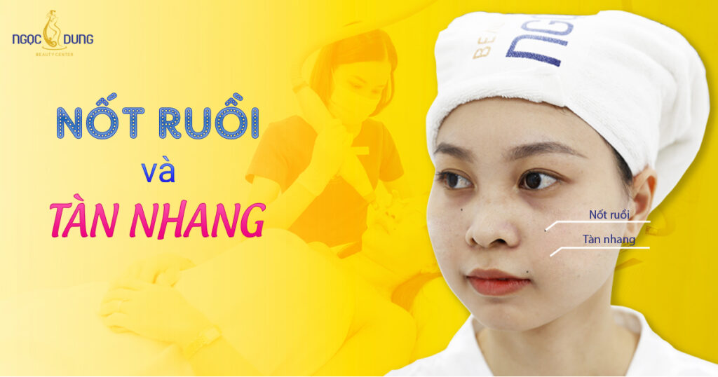 Nốt ruồi và tàn nhang