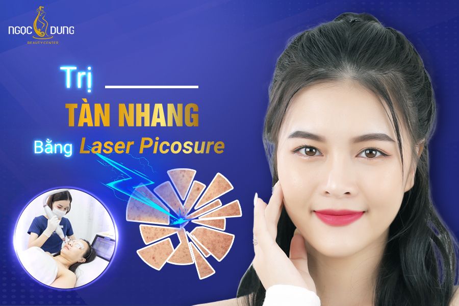 Trị tàn nhang bằng laser picosure