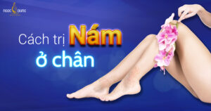 cách trị nám ở chân