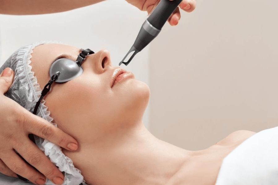 Laser là một trong những phương pháp trị nám nhẹ hiệu quả nhất hiện nay