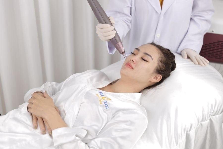 Ngoài khả năng làm mờ sắc tố, laser còn kích thích tăng sinh collagen và tái tạo da, giúp cải thiện cấu trúc da sau điều trị