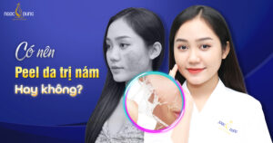 peel da trị nám