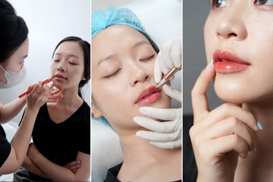 Phun hồng môi tại Ngọc Dung còn ghi điểm nhờ kỹ thuật không sưng đau