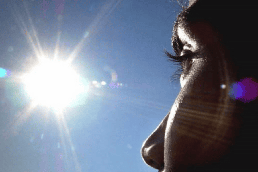 Các loại nám da phổ biến: Đặc điểm, nguyên nhân và cách điều trị hiệu quả 10 Tia UV từ ánh nắng mặt trời chiếm đến 70% nguyên nhân hình thành nám da