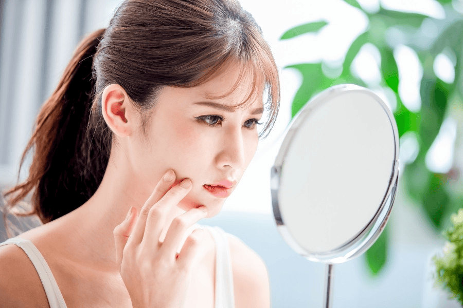 Cần can thiệp sớm tình trạng da mặt bị nám nhẹ để rút ngắn thời gian điều trị và giảm nguy cơ tái phát về sau