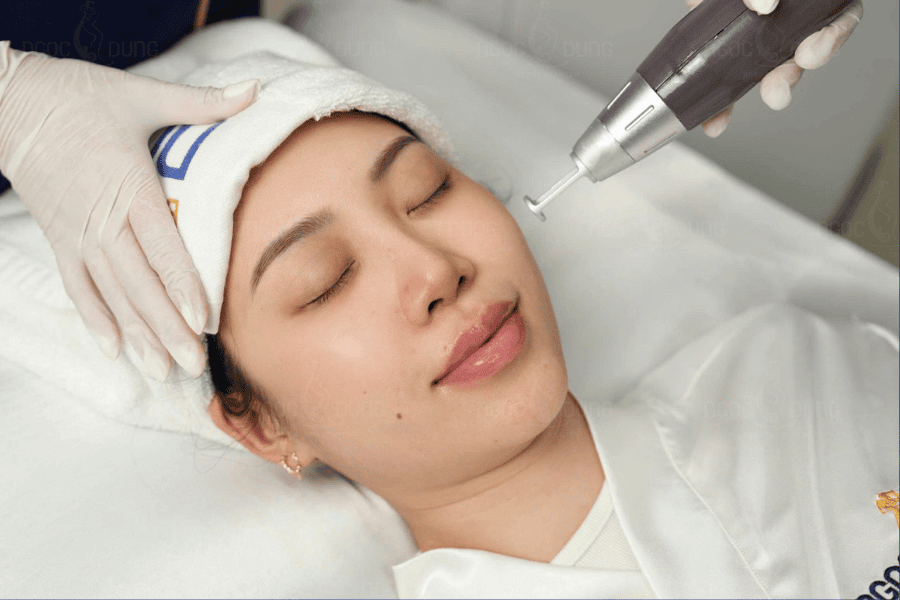 Da khỏe đẹp trắng sáng chỉ sau 1 liệu trình trị nám tại TMV Ngọc Dung