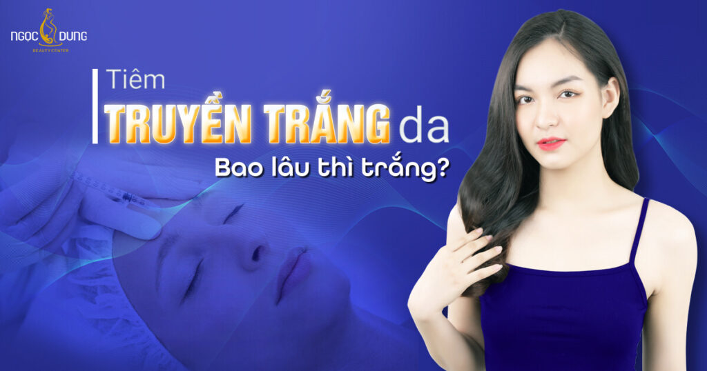 truyền trắng tmv Ngọc Dungtruyền trắng tmv Ngọc Dung