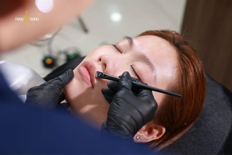 Ưu tiên phun môi tại các cơ sở có đội ngũ chuyên gia giàu kinh nghiệm
