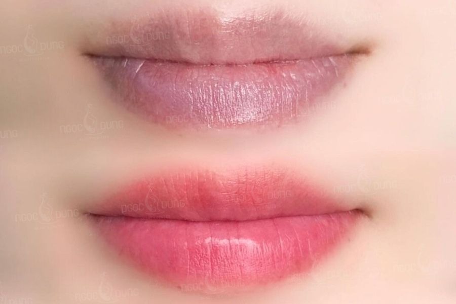 Dịch vụ xăm môi tại Thẩm mỹ viện Ngọc Dung được nhiều người tin tưởng lựa chọn