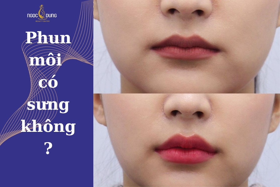 Phun Môi Bị Sưng: Làm Thế Nào Để Giảm Sưng Nhanh và An Toàn?