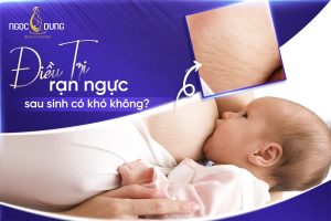 20260223 Pos SEO 2 1