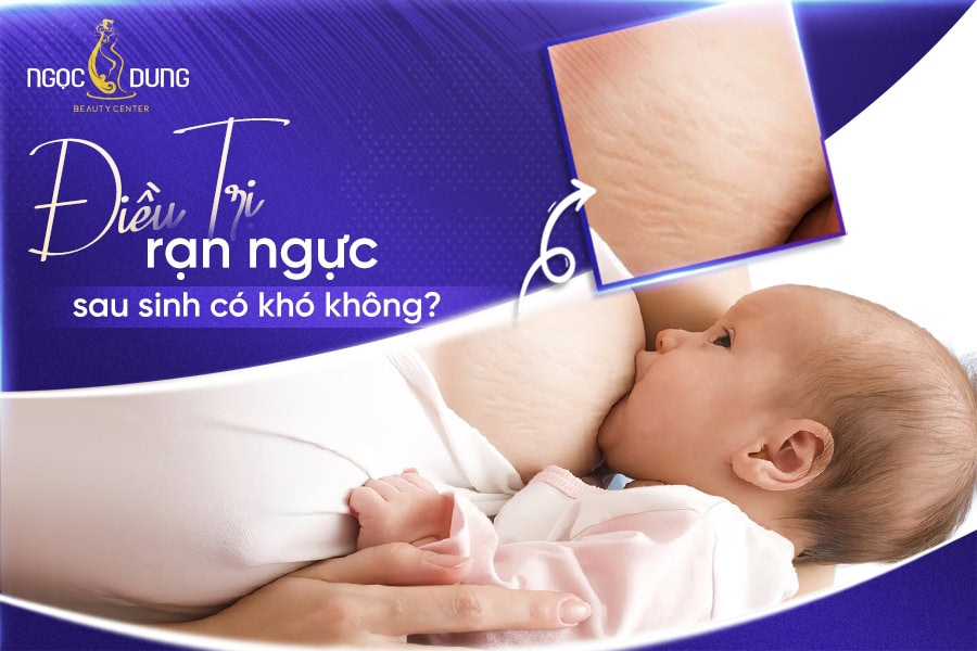 20260223 Pos SEO 2 1