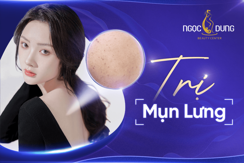 Nguyên nhân và 13 cách trị mụn lưng và vai cho nam và nữ