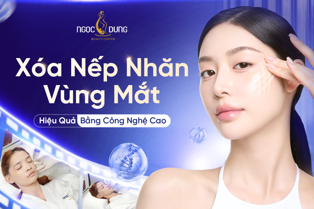 20260306 Pos SEO 930