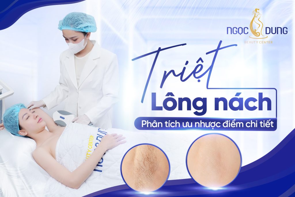 Cách tẩy lông vùng kín an toàn và hiệu quả nhất cho nữ