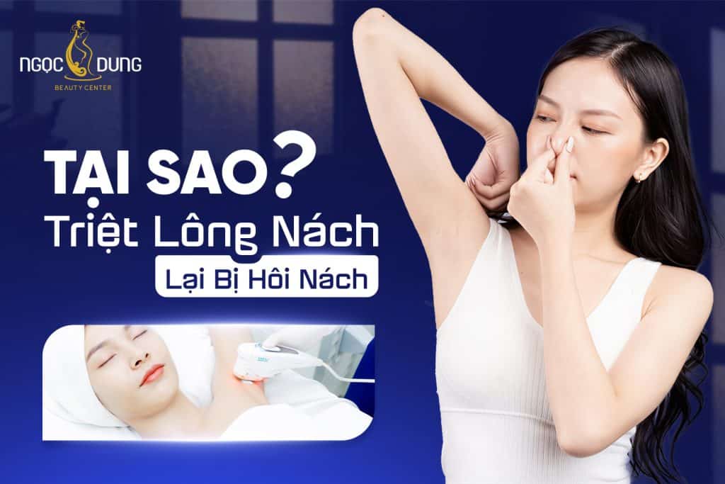 Tại sao triệt lông nách lại bị hôi nách? Cách xử lý đúng