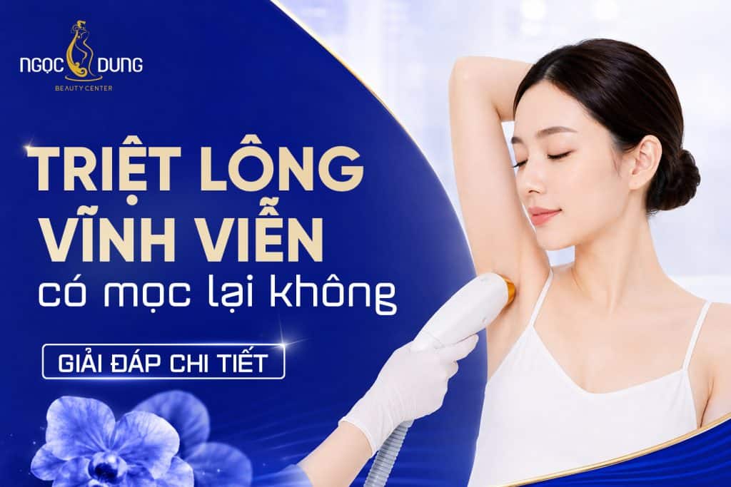 Triệt lông vĩnh viễn có mọc lại không? Những điều cần biết