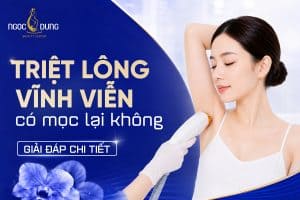 Triệt lông vĩnh viễn có mọc lại không? Những điều cần biết