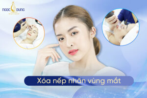 8 Cách xóa nếp nhăn vùng mắt hiệu quả, da căng mướt trẻ trung