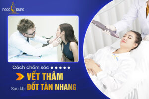 Làm gì sau khi đốt tàn nhang? Mách bạn các cách chăm sóc vết thâm sau khi đốt tàn nhang