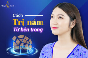 Bật mí các cách trị nám từ bên trong