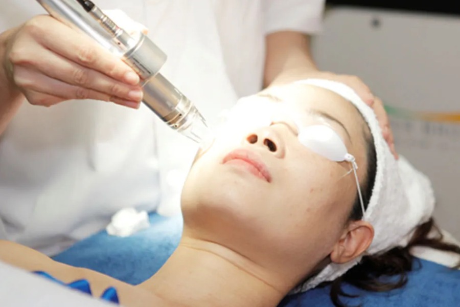 Cách trị sẹo lõm bằng phương pháp laser Cách trị sẹo lõm bằng phương pháp laser và làm đầy này cần được thực hiện dưới sự giám sát của bác sĩ chuyên nghiệp