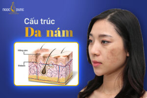 Tìm hiểu về cấu trúc da nám
