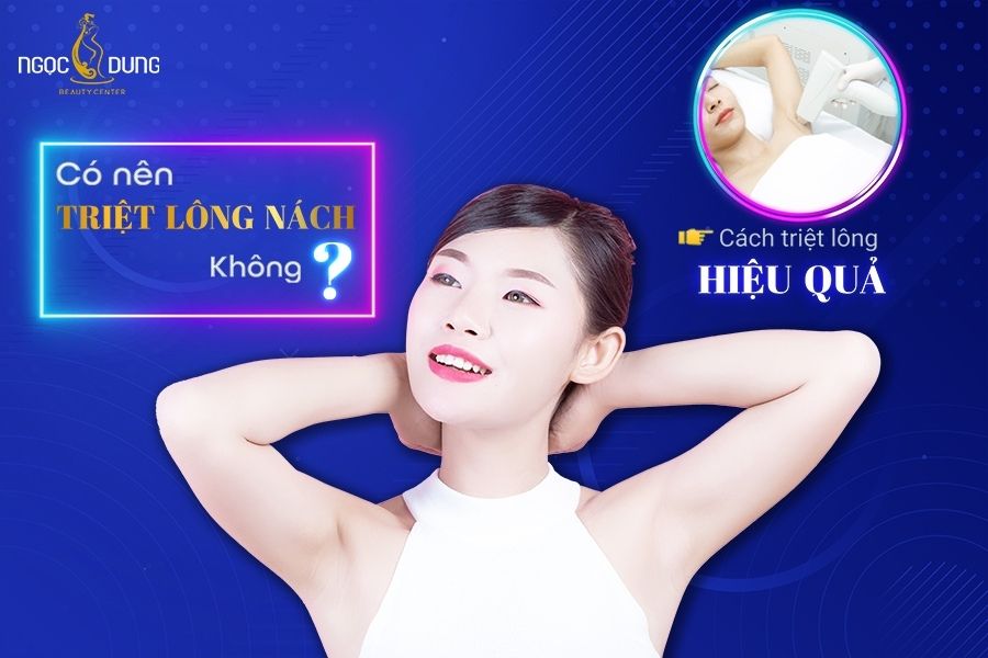 Có nên triệt lông nách hay không? Đâu là phương pháp triệt lông nách hiệu quả