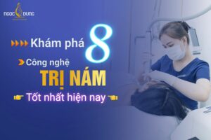 Công nghệ trị nám tốt nhất hiện nay